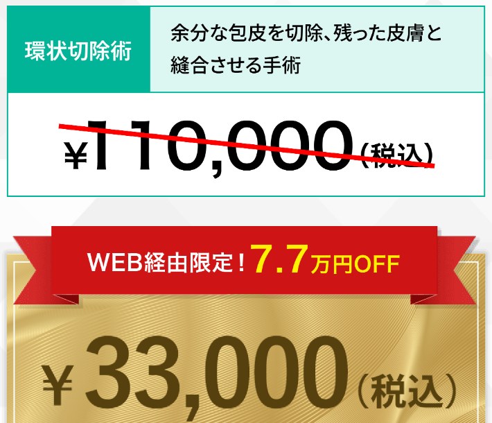 東京ノーストクリニックの環状切除術はWEB経由限定で33,000円(公式LP)