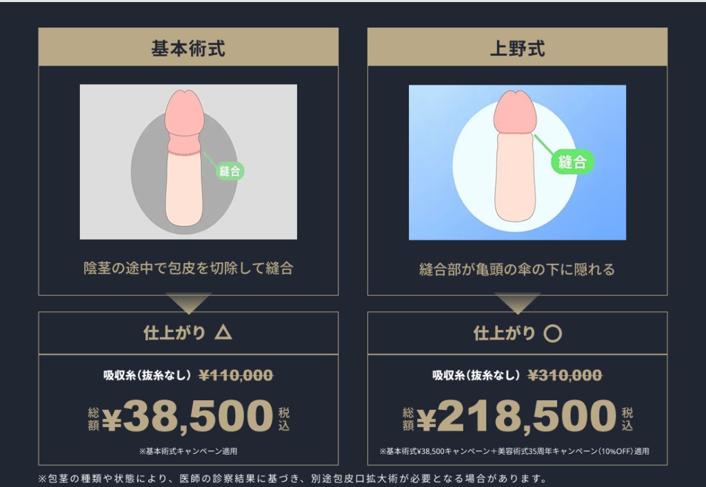 上野クリニックの基本術式と上野式の違いと総額(公式サイトの料金表)